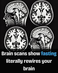Top 5 New Findings About Fasting That Will Change Your Mind 2 image 341